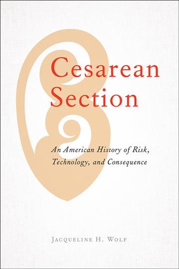 Cesarean section : an American history of risk, technology, and consequence / Jacqueline H. Wolf.